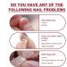 Dajidafu Nails Repairing Extension Gel Portable Fingernail Manicure Pedicure Polish Accessory for Household Professional Salons - Buy Online on SooperMarket.com