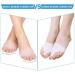 DOACT 3-Hole Bunion Corrector Protector with 5-Hole Big Toe Straighteners Gel Toe Separator Foot Splint Support for Hallux Valgus Overlapping Hammer Turf Bent Toe Day and - Buy Online on SooperMarket.com