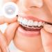 EXCEART Teeth Power Chains Spool - Orthodontic Elastic Brace Rubber Bands for Dental Care - Buy Online on SooperMarket.com