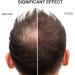 Hair Building Fibers Hair Building Fibres Powder Hair Fibres Dark Brown Hair Fibres For Thinning Hair Hair Loss Concealer Fiber Hair Building Fibres & Hair Fibers (Dark Brown) - Buy Online on SooperMarket.com
