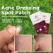 Acne Dressing Spot Patch Acne Paste Transparent Pimple Patch Breathable Painless Acne Treatment Gel Patch Skin Care Absorb Pus Rapid Healing Effective Antibacterial Protection 36 Patches - Buy Online on SooperMarket.com