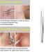 9PCS Blackhead Remover Comedone Extractor Kit with Tweezers and Free Eyebrow Brush - Buy Online on SooperMarket.com