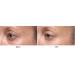 Dr. Dennis Gross Ferulic + Retinol Triple Correction Eye Serum 0.5 fl oz - Targets Wrinkles, Elasticity Loss, Rough Texture - (Pack of 1) - Buy Online on SooperMarket.com