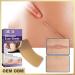 WAITLOVER Skin Color Reusable Silicone Scar Removal Patch - Surgical Self-Adhesive Soft Gel Strip for Burn Repair - Buy Online on SooperMarket.com