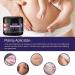 Scar Repair Cream | Acne Scar Removal | Pigmentation Corrector - 10/30/50g - Buy Online on SooperMarket.com