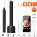 KANDUO Earwax Removal Kit with 1080P HD Endoscope | Ear Cleaner with Camera and 6 LED Lights - Buy Online on SooperMarket.com
