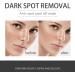 Dark Spot Remover for Face Hyaluronic Acid Dark Spot Correcting Serum Anti Aging Face Serum for Women Nicotinamide Dark Spot Correcting Glow Serum Anti Spot Face Serum and Oil Skin Moisturizer-30ml - Buy Online on SooperMarket.com