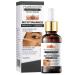 Dark Spot Remover for Face Hyaluronic Acid Dark Spot Correcting Serum Anti Aging Face Serum for Women Nicotinamide Dark Spot Correcting Glow Serum Anti Spot Face Serum and Oil Skin Moisturizer-30ml