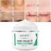 Scar Repair Cream | Acne Scar Removal & Pigmentation Corrector | Stretch Mark Remover | Skin Whitening | Scar Care - Buy Online on SooperMarket.com