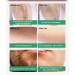 Laser Hair Removal for Women - Permanent Painless IPL Device, Upgraded to 999,999 Flashes, 5 Energy Levels, 2 Modes - Beautify Skin Face Body Bikini - Light Green - Buy Online on SooperMarket.com