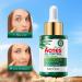 Tea Tree Oil for Face - Acne Serum & Blemish Spot Treatment - Unclogs Pores Soothes Breakouts - 1 fl oz for Smooth Glowing Skin - Buy Online on SooperMarket.com