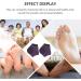 Milists 5 Pairs Moisturizing Gel Spa Socks for Cracked Heels - Heel Protection & Cushion | Slide-Resistant Foot Care - Buy Online on SooperMarket.com