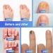 XIFEPFR Toenail Repair Pen - Nail Fingernail Repair Pen for Thick  Broken  Discolored Nails - Restores Healthy Strong Nails - 4PCS - Buy Online on SooperMarket.com
