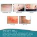 Silicone Scar Tape 4cm x 1.5m - Self Adhesive & Non-irritating - C Section & Burn Scar Removal - Meat Color - Buy Online on SooperMarket.com