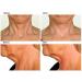 Neck Rescue Instant Correcting Strips - Improve & Tighten Neckline - 30 Count - Buy Online on SooperMarket.com