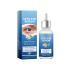 Stye Eye Treatment Chalazion Remover Eye Relief Serum for Styes Mild Lash and Eye Cleanser