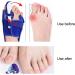 Bunion Toe Separator for Pain-Free Movement | Adjustable Strength | Comfortable Soft Fabric | Right Toe Splint for Daily Use - Buy Online on SooperMarket.com