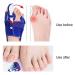 Bunion Toe Separator & Straightener for Hallux Valgus Correction - Toe Spacer & Overlapping Toes Corrector for Men and Women (Right) - Buy Online on SooperMarket.com