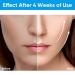Electric Double Chin Reducer with Blue Red Light for Skin Lifting & Shaping - Buy Online on SooperMarket.com