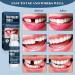 Temporary Tooth Set Tooth Repair Kit Temporary Teeth Replacement Kit for Chipped Teeth Moldable False Teeth Temporary Filling for Tooth - Buy Online on SooperMarket.com