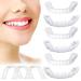 Fake Teeth  6 PCS Cosmetic Denture Veneers for Upper and Lower Jaw  Natural Shade Fake Veneer  Denture Decorations for Christmas and Daily Life-01 6pcs-01