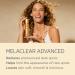 Isdinceutics Melaclear Advanced Dark Spot Corrector with Niacinamide 1.7 FL OZ - Buy Online on SooperMarket.com