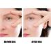Wrinkle Patch Eliminate Wrinkles Patch Light in Weight Designed To Remove Wrinkles Around the Eyes for Home Use - Buy Online on SooperMarket.com