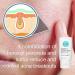 CONTROL CORRECTIVE Clear Med 10% Acne Treatment Lotion - 2.5 Oz | Benzoyl Peroxide & Sulfur Formula for Breakouts | Kills Acne Bacteria, Dries Blemishes - Buy Online on SooperMarket.com