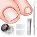 (60+2) Pack Ingrown Toenail Treatment, Include 60 PCS Ingrown Toenail Corrector Strips, Ingrown Toenail Lifter And Nail Clipper, Professional Ingrown Toenail Correction Tool
