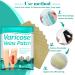 Fengyang 16Pcs Varicose Veins Treatment Patch Set for Legs - Spider Vein Relief, Soothes Leg Fatigue - Buy Online on SooperMarket.com