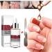 1PC Nail Treatment Nail Renewal Solution Toenails & Fingernails Nail Repairs Essential Oil Protects Toenail Fungus Treatment From Discoloration Brittle And Cracked Nail(12ML) - Buy Online on SooperMarket.com