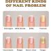NailGrowth DeepHealing Organic Serum NailGrowth Nail Serum Reconstrux Nail Growth Nail Growth and Strengthening Serum Nail Serum for Growth and Repair for Damaged Nails (3pcs) - Buy Online on SooperMarket.com