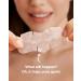 LitBear XL T-Zone Patch - 30 Patches, Hydrocolloid for Nose, Forehead, Chin, Pimple, with Tea Tree & Calendula Oil - Buy Online on SooperMarket.com