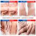 TIS CREME with 15% Urea - Eczema Psoriasis Dry Skin Relief | Wound Healing for Hands Feet Knees & Nails | 50 ml Pack - Buy Online on SooperMarket.com