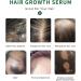 PrimeCove - Biotin & Tea Tree Hair Growth Serum (30ml) | Stimulate Growth Reduce Graying & Nourish Roots | Advanced & Natural Formula - Buy Online on SooperMarket.com