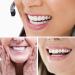 2 Pairs of Fake Teeth Veneers for Men and Women - Cosmetic Tooth Repair Kit - Buy Online on SooperMarket.com