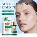 Tea Tree Oil for Face - Acne Serum & Blemish Spot Treatment - Unclogs Pores Soothes Breakouts - 1 fl oz for Smooth Glowing Skin - Buy Online on SooperMarket.com