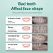 Risely Temporary Whitening Veneers - 2 Pairs of Artificial Teeth for Men & Women | Plug-In Braces & Lightening Dentures - Buy Online on SooperMarket.com