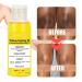 Super Strength Yellow Peeling Oil for Dark Skin - 30/50ml Exfoliating Lightening Treatment - Extra Strength for All Skin Types - Buy Online on SooperMarket.com