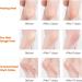 Nado Care Large Moisturizing Gel Socks for Dry Cracked Heels - 5 Pair Set - Buy Online on SooperMarket.com