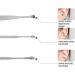 Portable Earwax Removal Kit 6 Pc Stainless Steel Ear Pick Earwax Cleaning Tool with A Customized Storage Box/1685 - Buy Online on SooperMarket.com