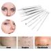 Pinkiou Blackhead Removers and Pimple Extractors Kit - 8-in-1 Skincare Tool for Face and Nose - Buy Online on SooperMarket.com