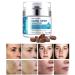 Dark Spot Remover for Face Fast-Acting Dark Spot Corrector Remover for Face and body Hyperpigmentation Fades Melasma Freckle Sun Spots Evens Skin Tone Age Spot Remover for Women Men