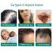 Hair Growth Serum - Thicker Longer Fuller Hair | Prevent Hair Loss & Thinning | Vitamin-Rich Natural Treatment - Shop Now - Buy Online on SooperMarket.com