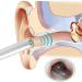 KANDUO Ear Wax Removal 5.5mm Otoscope with LED Lights - Ear Cleaning Camera Tool - Buy Online on SooperMarket.com
