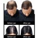 1BAG Hair Building Fibers Instant Hair Loss Treatment Color Powder Conceal Thinning Hair Add Volume For Both Men & Women(Black)  - Buy Online on SooperMarket.com