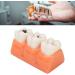 4-Fold Dental Caries Model - Synthetic Resin Oral Care Training Tool for Students | Safe & Realistic Simulation - Buy Online on SooperMarket.com