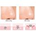 Silicone Nose & Lip Cleansing Brush Set for Blackhead & Exfoliation - Rose Red - Buy Online on SooperMarket.com