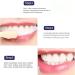 Body Accel Whitening Toothpaste | Fresh Breath & Stain Removal | Dazzling White - 1PCS | International Shipping Available - Buy Online on SooperMarket.com