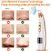 2023 Blackhead Remover Pore Vacuum - Upgraded Electric Facial Cleaner for Acne, Whiteheads - 5 Suction Power, 5 Probes - USB Rechargeable Kit for Women & Men - Buy Online on SooperMarket.com